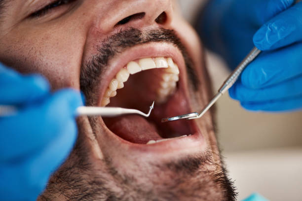 Best Emergency Dentist for Knocked-Out Tooth in Astia, OR